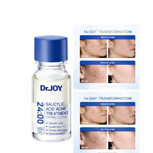 Acne-fighting Serum Containing Salicylic Acid To Control Oil And Combat Acne